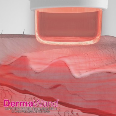 DermaWand - dispozitiv pentru ingrijirea pielii | Produs Original de la Telestar DermaWand - dispozitiv pentru ingrijirea pielii | Produs Original de la Telestar
