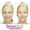 DermaWand - dispozitiv pentru ingrijirea pielii | Produs Original de la Telestar
