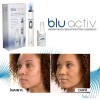 Blu-Activ - sistem revolutionar impotriva cosurilor | Produs Original de la Telestar