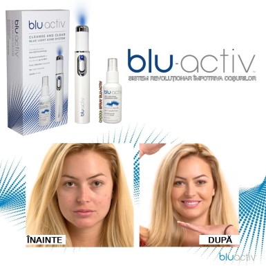 Blu-Activ - sistem revolutionar impotriva cosurilor | Produs Original de la Telestar Blu-Activ - sistem revolutionar impotriva cosurilor | Produs Original de la Telestar