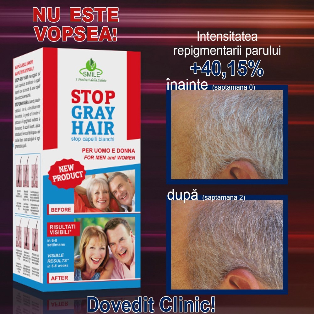 Stop Gray Hair - metoda care reda parului carunt culoarea naturala | Produs  Original de la Telestar
