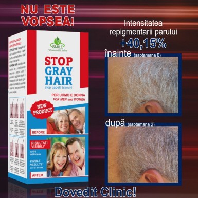 Stop Gray Hair - metoda care reda parului carunt culoarea naturala | Produs Original de la Telestar Stop Gray Hair - metoda care reda parului carunt culoarea naturala | Produs Original de la Telestar
