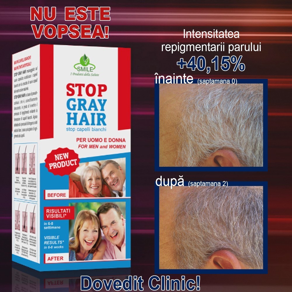 Stop Gray Hair - metoda care reda parului carunt culoarea naturala | Produs Original de la Telestar