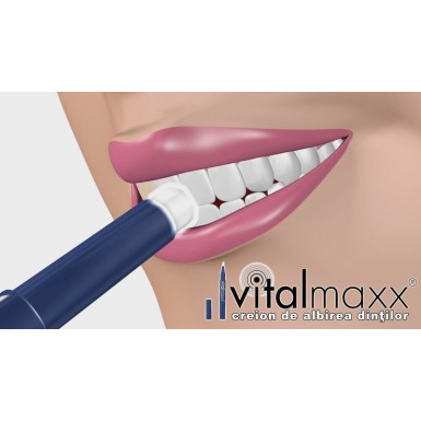 VitalMaxx Tooth Whitener - Creion de albire a dintilor | Produs Original de la Telestar VitalMaxx Tooth Whitener - Creion de albire a dintilor | Produs Original de la Telestar