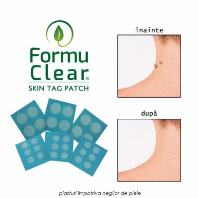 Formuclear Skin Tag Patch Formuclear Skin Tag Patch
