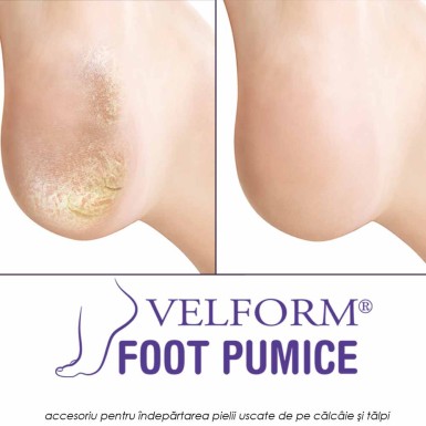 Velform Foot Pumice - noul accesoriu pentru indepartarea pielii uscate de pe calcaie si talpile picioarelor Velform Foot Pumice - noul accesoriu pentru indepartarea pielii uscate de pe calcaie si talpile picioarelor