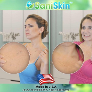 Pachet PROMO: FormuClear Skin Tag Patch + SaniSkin Pachet PROMO: FormuClear Skin Tag Patch + SaniSkin