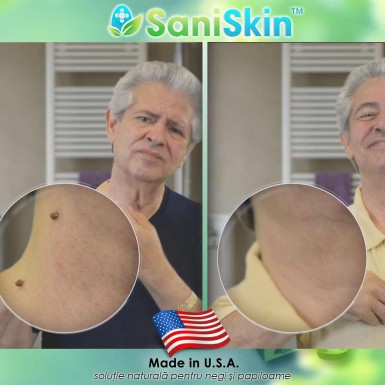 Pachet PROMO: FormuClear Skin Tag Patch + SaniSkin Pachet PROMO: FormuClear Skin Tag Patch + SaniSkin