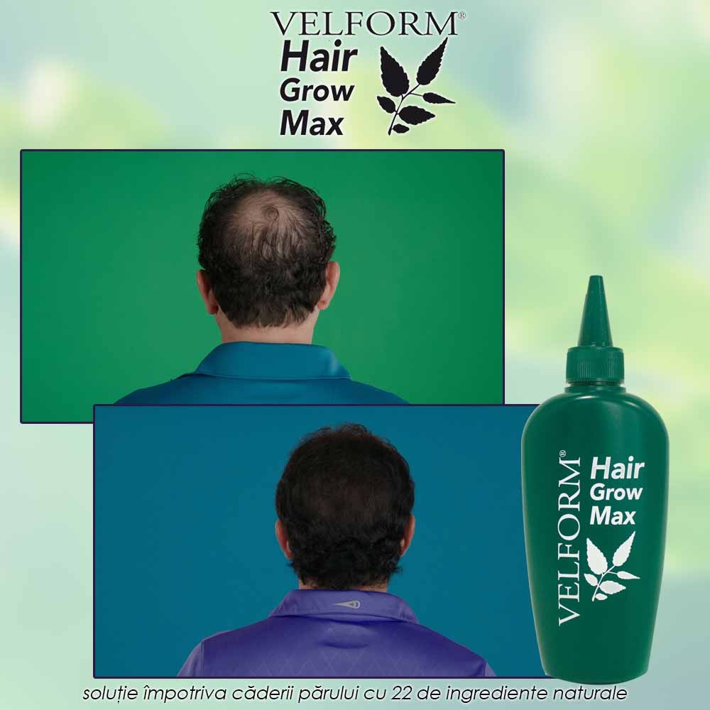 Velform Hair Grow Max - solutie impotriva caderii parului cu 22 de ingrediente naturale