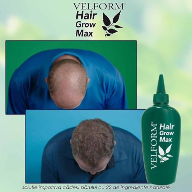 Velform Hair Grow Max - solutie impotriva caderii parului cu 22 de ingrediente naturale Velform Hair Grow Max - solutie impotriva caderii parului cu 22 de ingrediente naturale
