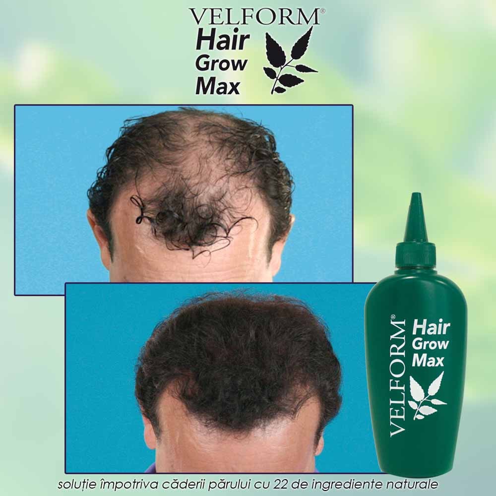 Velform Hair Grow Max - solutie impotriva caderii parului cu 22 de ingrediente naturale