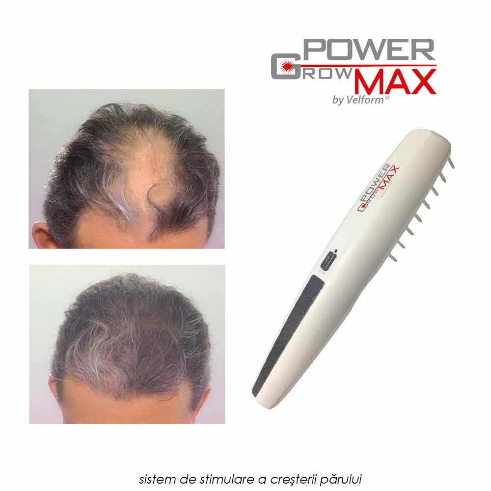 Power Grow Max - sistem de stimulare a cresterii parului, cu rezultate dovedite clinic