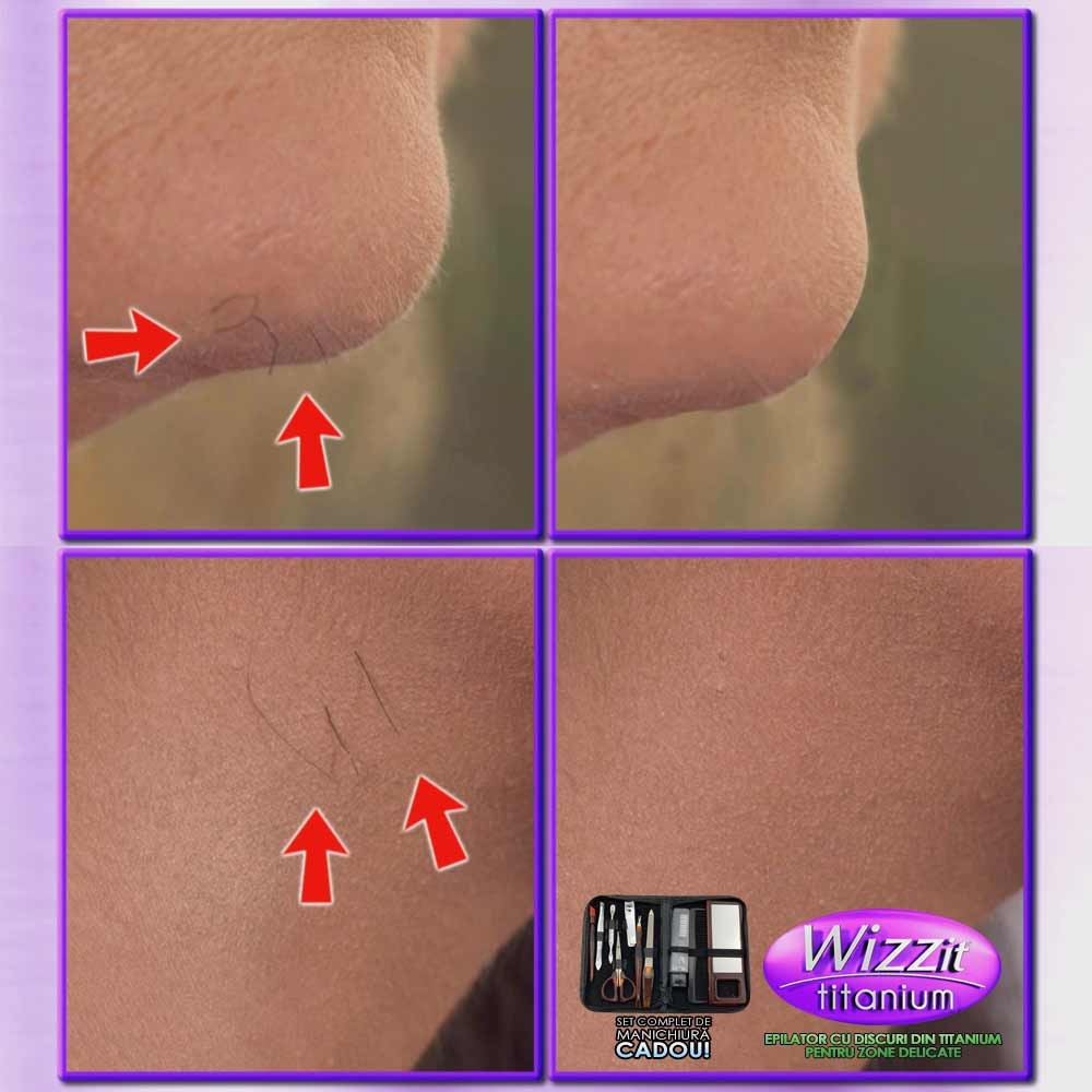 Wizzit Titanium - epilator cu discuri din titanium pentru zone delicate