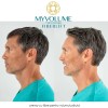 MyVolume - crema cu fibre pentru volumul parului