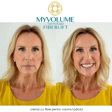 MyVolume - crema cu fibre pentru volumul parului MyVolume - crema cu fibre pentru volumul parului
