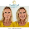 MyVolume - crema cu fibre pentru volumul parului