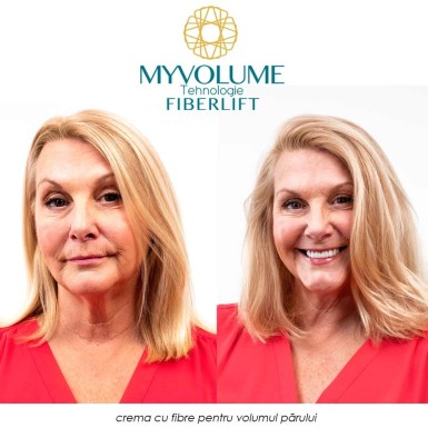 MyVolume - crema cu fibre pentru volumul parului MyVolume - crema cu fibre pentru volumul parului