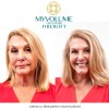 MyVolume - crema cu fibre pentru volumul parului