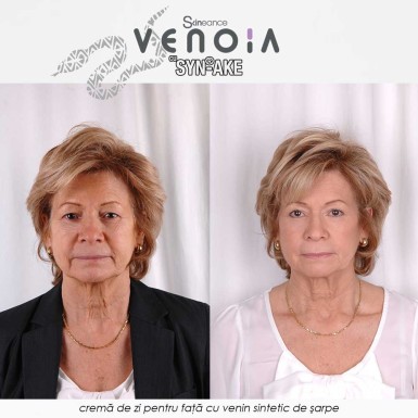 Venoia Syn-Ake Day Face Cream 50ml - crema de zi pentru fata cu venin sintetic de sarpe Venoia Syn-Ake Day Face Cream 50ml - crema de zi pentru fata cu venin sintetic de sarpe