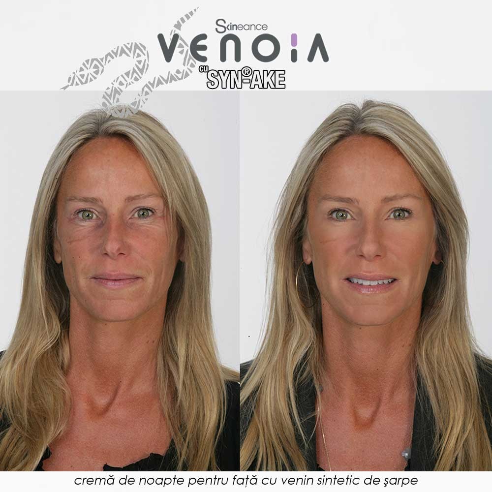 Venoia Syn-Ake Night Face Cream 50ml - crema de noapte pentru fata cu venin sintetic de sarpe Venoia Syn-Ake Night Face Cream 50ml - crema de noapte pentru fata cu venin sintetic de sarpe