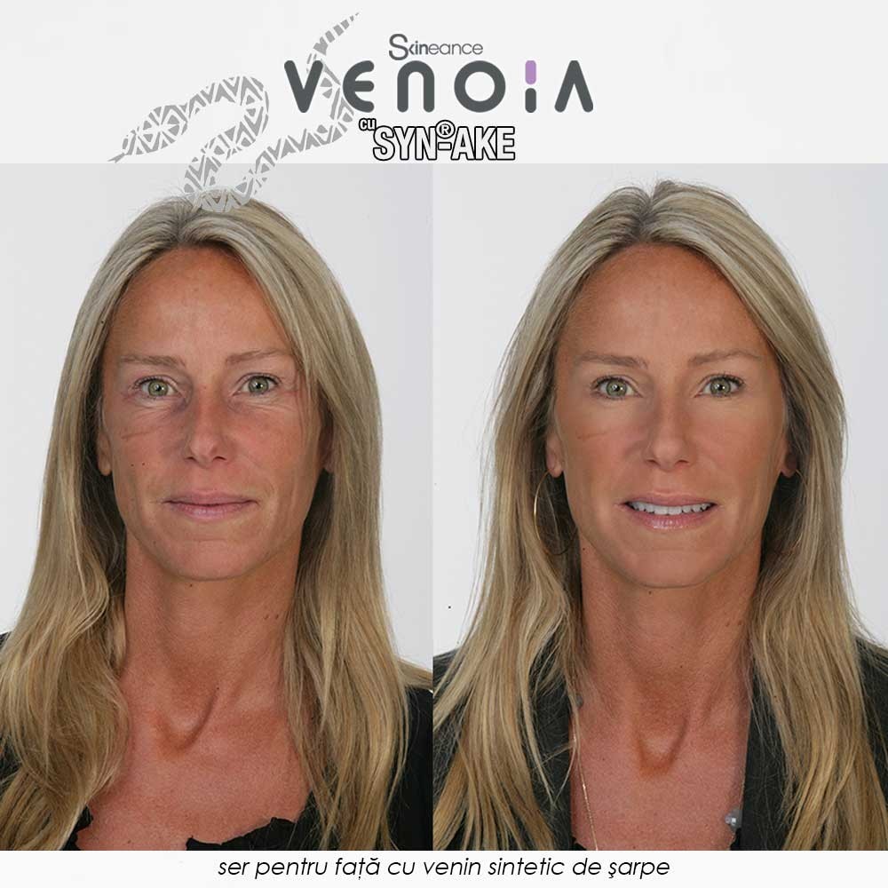Venoia Syn-Ake Face Serum - ser pentru fata cu venin sintetic de sarpe
