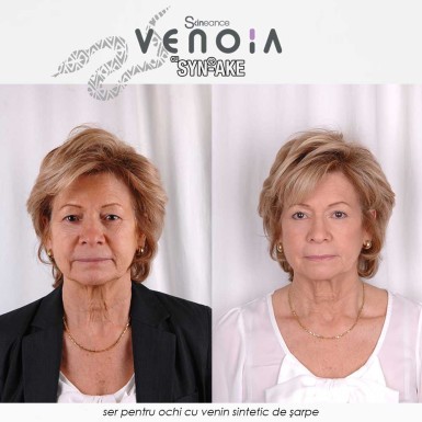 Venoia Syn-Ake Eye Serum - ser pentru ochi cu venin sintetic de sarpe Venoia Syn-Ake Eye Serum - ser pentru ochi cu venin sintetic de sarpe