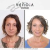 Venoia Syn-Ake Eye Serum - ser pentru ochi cu venin sintetic de sarpe Venoia Syn-Ake Eye Serum - ser pentru ochi cu venin sintetic de sarpe