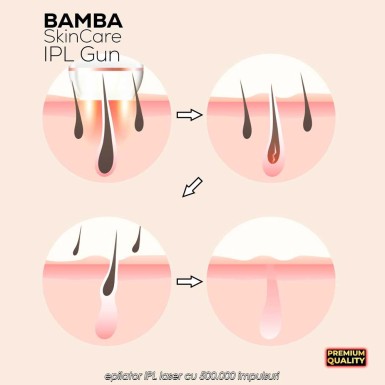 Bamba SkinCare IPL Gun - epilator IPL laser cu 500.000 impulsuri Bamba SkinCare IPL Gun - epilator IPL laser cu 500.000 impulsuri
