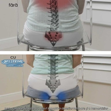 Wellprime Painfree Cushion - perna ortopedică pentru șezut împotriva durerilor lombare și a hemoroizilor Wellprime Painfree Cushion - perna ortopedică pentru șezut împotriva durerilor lombare și a hemoroizilor
