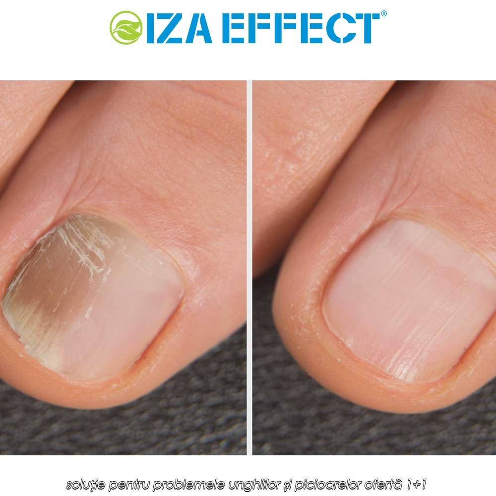IZA Effect - soluție pentru problemele unghiilor și picioarelor ofertă 1+1
