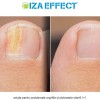 IZA Effect - soluție pentru problemele unghiilor și picioarelor ofertă 1+1