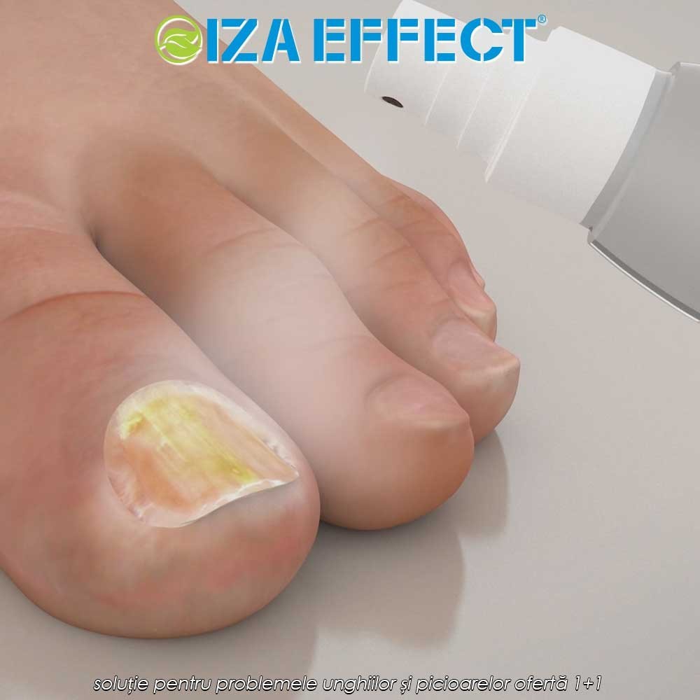 IZA Effect - soluție pentru problemele unghiilor și picioarelor ofertă 1+1
