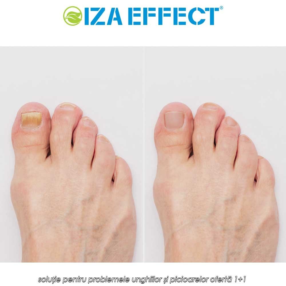 IZA Effect - soluție pentru problemele unghiilor și picioarelor ofertă 1+1
