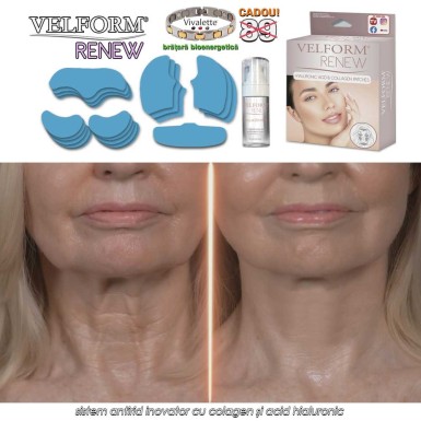 Velform Renew - sistem antirid inovator cu colagen și acid hialuronic Velform Renew - sistem antirid inovator cu colagen și acid hialuronic