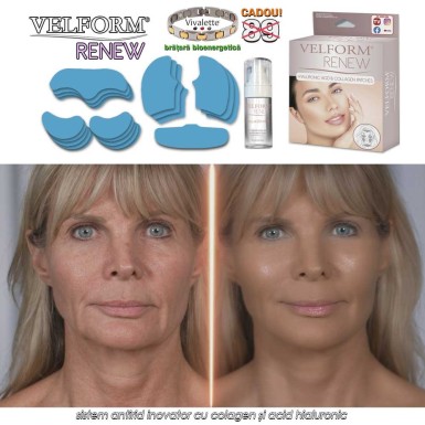 Velform Renew - sistem antirid inovator cu colagen și acid hialuronic Velform Renew - sistem antirid inovator cu colagen și acid hialuronic