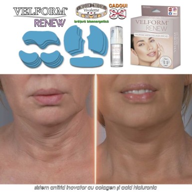 Velform Renew - sistem antirid inovator cu colagen și acid hialuronic Velform Renew - sistem antirid inovator cu colagen și acid hialuronic