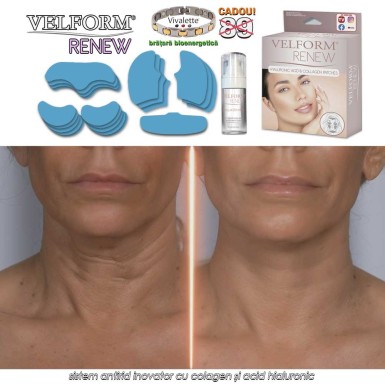 Velform Renew - sistem antirid inovator cu colagen și acid hialuronic Velform Renew - sistem antirid inovator cu colagen și acid hialuronic