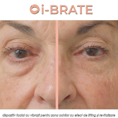 i-BRATE - dispozitiv facial cu vibrații pentru zona ochilor cu efect de lifting și revitalizare