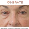 i-BRATE - dispozitiv facial cu vibrații pentru zona ochilor cu efect de lifting și revitalizare