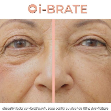 i-BRATE - dispozitiv facial cu vibrații pentru zona ochilor cu efect de lifting și revitalizare