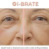i-BRATE - dispozitiv facial cu vibrații pentru zona ochilor cu efect de lifting și revitalizare