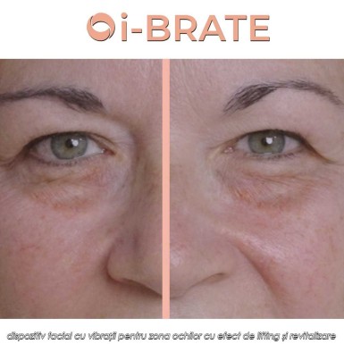 i-BRATE - dispozitiv facial cu vibrații pentru zona ochilor cu efect de lifting și revitalizare