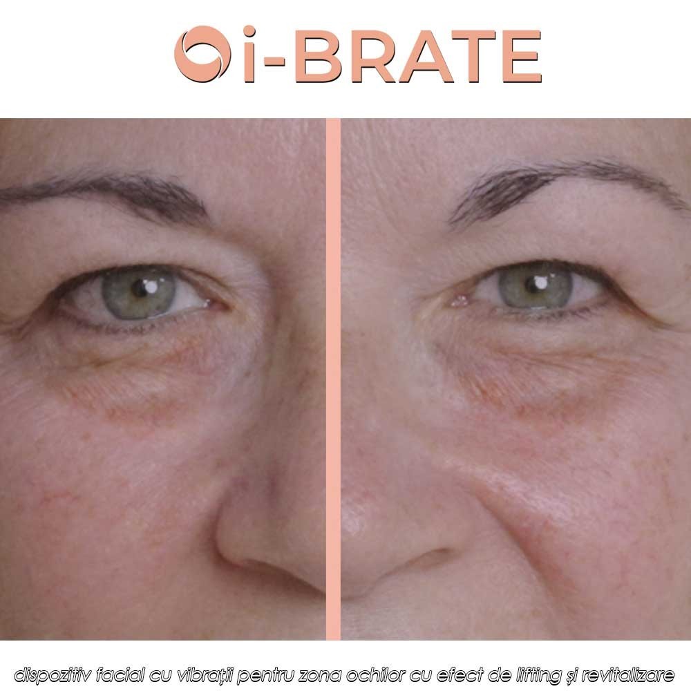 i-BRATE - dispozitiv facial cu vibrații pentru zona ochilor cu efect de lifting și revitalizare